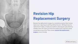 Revision Hip Replacement Surgery