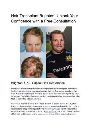 Hair Transplant Brighton