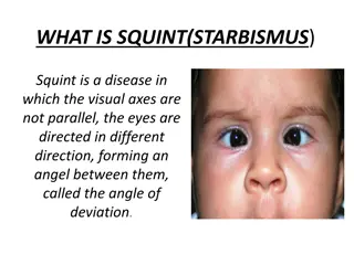 Understanding Squint (Starbismus) and Treatment Options