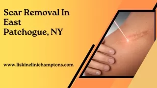 Scar Removal In East Patchogue, NY