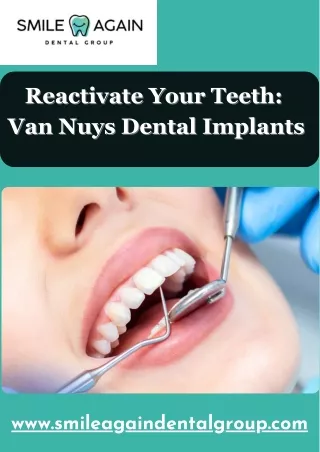 Reactivate Your Teeth Getting Van Nuys Dental Implants