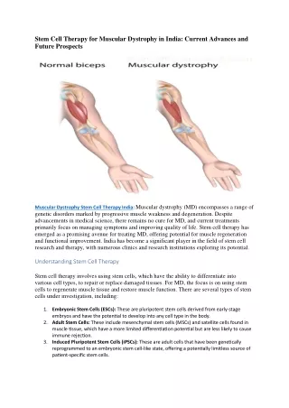 Stem Cell Therapy for Muscular Dystrophy in India