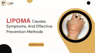 Lipoma Causes, Symptoms, And Effective Prevention Methods