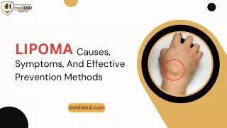 Lipoma Causes, Symptoms, And Effective Prevention Methods