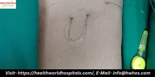 Healthworld Hospitals Pioneering Quality Care & Innovation in Durgapur