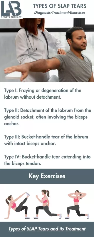 Types of SLAP Tears and its Treatment Physical Therapy