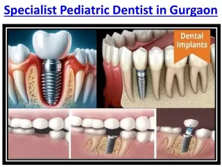 Painless Root Canal Treatment Dentistry in Gurgaon