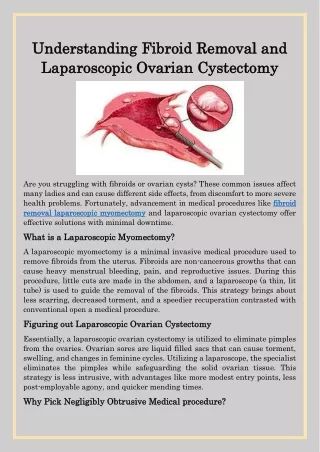 Understanding Fibroid Removal and Laparoscopic Ovarian Cystectomy