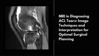 Pristyn Care - MRI in Diagnosing ACL Tears Image Techniques and Interpretation for Optimal Surgical Planning