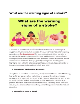 Identifying Stroke Symptoms: Act Quickly for Better Outcomes