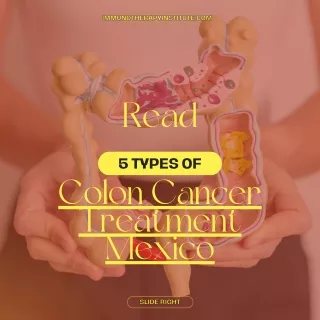 Colon Cancer Treatment Mexico