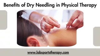 Benefits of Dry Needling in Physical Therapy