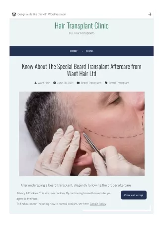 Know About The Special Beard Transplant Aftercare from Want Hair Ltd