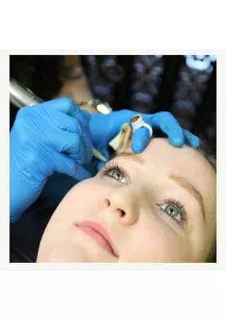 IPL (Intense Pulsed Light)