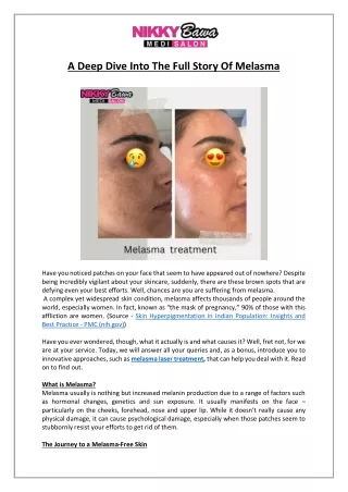 What is Melasma? How to Cure It?