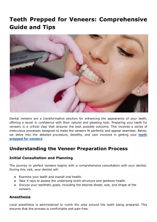 Teeth Prepped for Veneers_ Comprehensive Guide and Tips