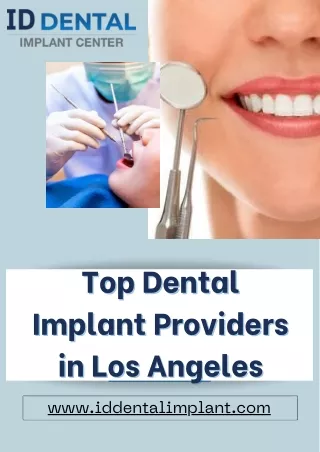 Top Dental Implant Providers in Los Angeles