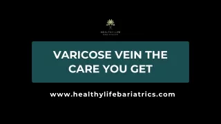 Varicose Vein The care you get- Healthy Life Bariatrics