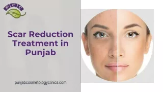 Scar Reduction Treatment in Punjab