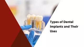 Types of Dental Implants and Their Uses