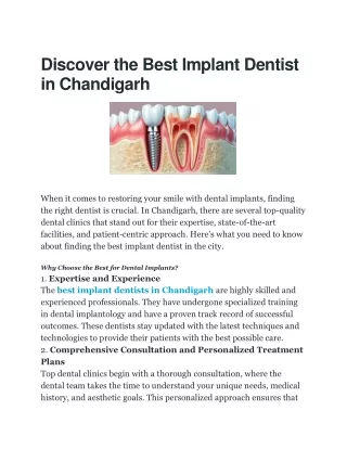 Best Implant Dentist in Chandigarh