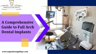 A Comprehensive Guide to Full Arch Dental Implants