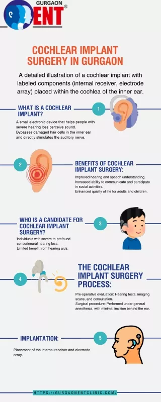 Cochlear Implant Surgery in Gurgaon