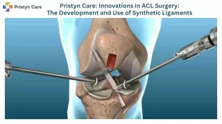 Pristyn Care Innovations in ACL Surgery The Development and Use of Synthetic Ligaments