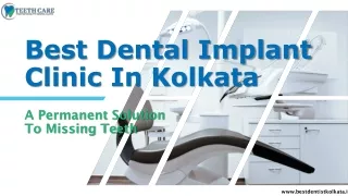 Best Dental Implant Clinic In Kolkata A Permanent Solution To Missing Teeth