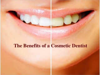 The Benefits of a Cosmetic Dentist