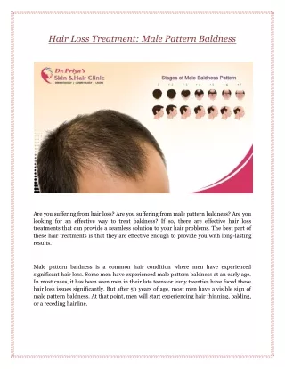 Hair Loss Treatment: Male Pattern Baldness