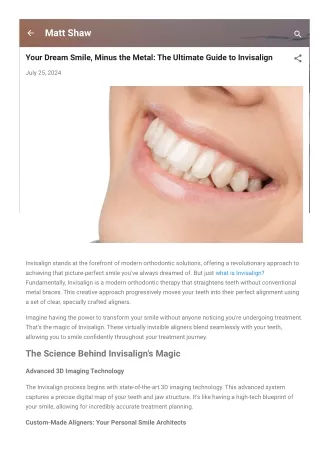 Your Dream Smile, Minus the Metal The Ultimate Guide to Invisalign
