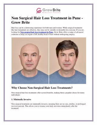 Effective Non-Surgical Hair Loss Treatment in Pune