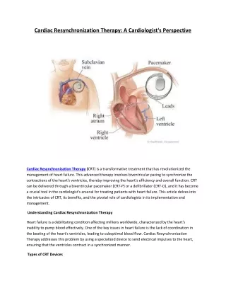 Cardiac Resynchronization Therapy: A Cardiologist's Perspective