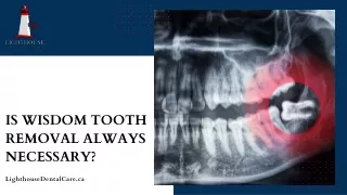 Is Wisdom Tooth Removal Always Necessary?