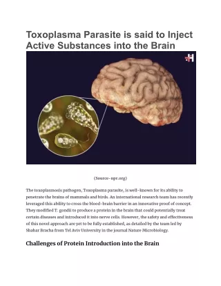 Toxoplasma Parasite is said to Inject Active Substances into the Brain (1)