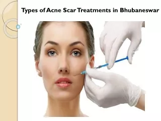 Types of Acne Scar Treatments in Bhubaneswar