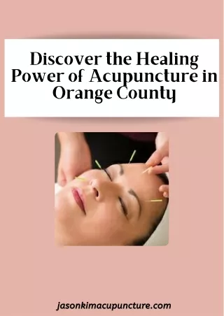 Discover the Healing Power of Acupuncture in Orange County (1)