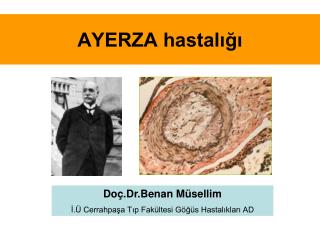 AYERZA hastalığı