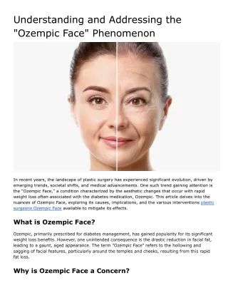 Plastic Surgeons’ Approach to Treating Ozempic Face: Comprehensive Solutions