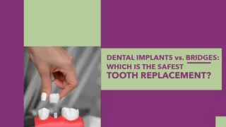 Innovative Dental Solutions for Lost Teeth