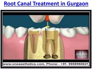 Benefits of Dental Aesthetics & Root Canal Treatment