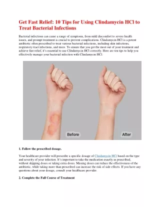 Get Fast Relief