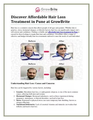 Effective and Affordable Hair Loss Treatment in Pune