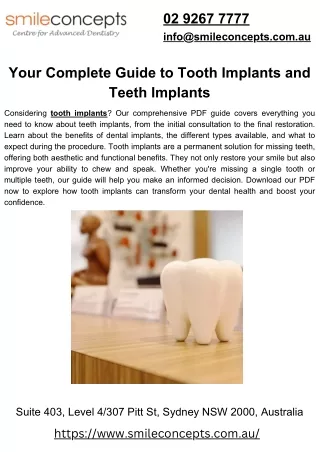 Your Complete Guide to Tooth Implants and Teeth Implants