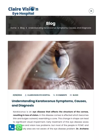 Understanding Keratoconus Symptoms, Causes, and Diagnosis