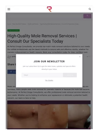 High-Quality Mole Removal Services | Consult Our Specialists Today