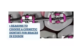 5 Reasons to Choose a Cosmetic Dentist for Braces in Edison