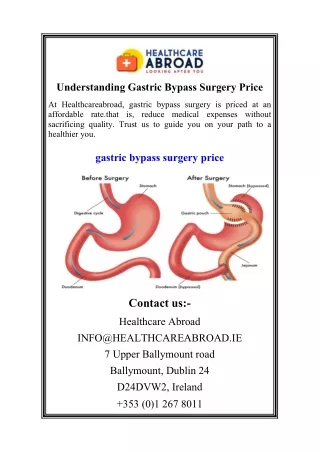 Understanding Gastric Bypass Surgery Price03