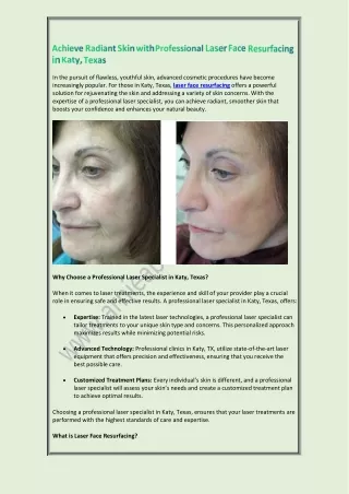 Achieve Radiant Skin with Professional Laser Face Resurfacing in Katy, Texas